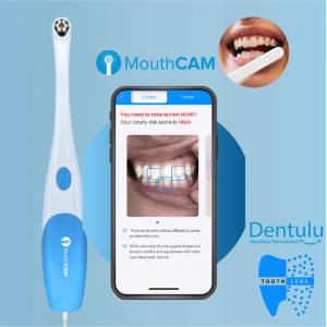 Teledentistry, Artificial Intelligence, Intraoral Camera, Dentulu, Toothlens, Mouthwatch